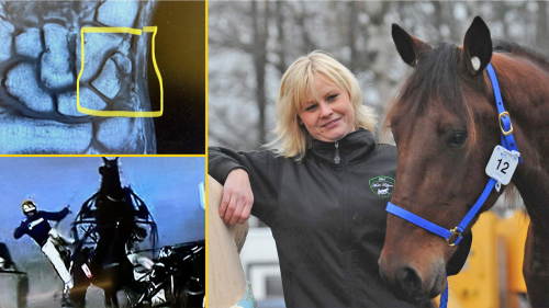 Fraktur stoppar Goop